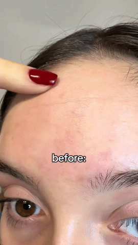 Retinal Shot Презентација